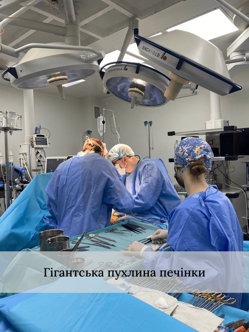 Пухлина-печінки.webp